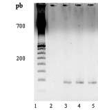 1- Marcador de massa molecular, 100bp DNA Ladder (Pharmacia), 2- Controle negativo, 3 - HD-1, 4 S234 e 5 S997 Fig. 19.