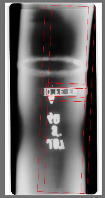 Detecção de Tubos em Imagens Radiográficas Digitais