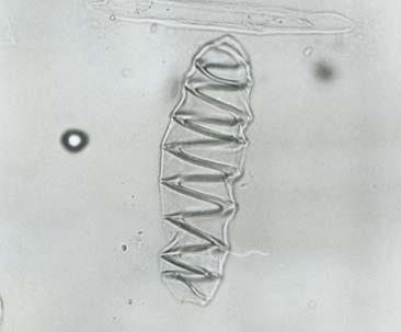 18. Detalhe da figura anterior, evidenciando o canal secretor de mucilagem (*).