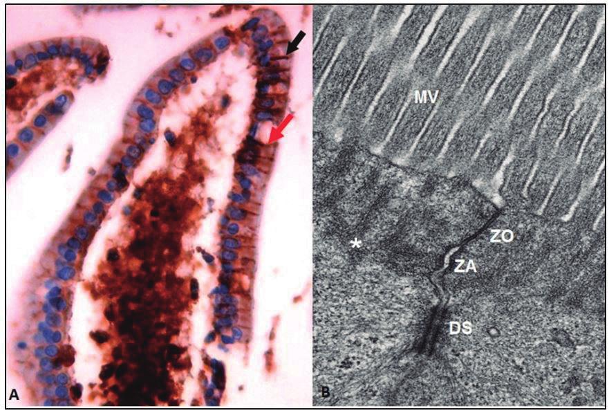 302 Sistema digestório: integração básico-clínica a um receptor da membrana apical dos enterócitos, denominado cubilina, que o internaliza por endocitose mediada por receptores, havendo