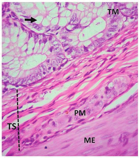 310 Sistema digestório: integração básico-clínica Figura 12.26 Fotomicrografia do intestino grosso com criptas contendo células caliciformes (seta). TM= túnica mucosa; TS: túnica submucosa.