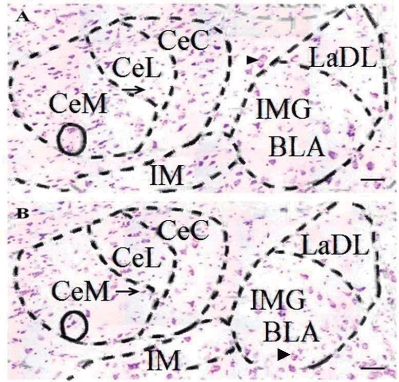 C, D Aumento da área evidenciada em A e B, mostrando a camada granulosa do giro denteado dos animais dos grupos e. Note os neurônios granulares (cabeças de seta) e as células da glia (setas).