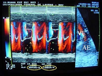 Cavalcanti et al. humanos, as ondas Et e At variam mais e são menos importantes na maioria das doenças cardíacas que as ondas Em e Am (Nagueh et al., 1996).