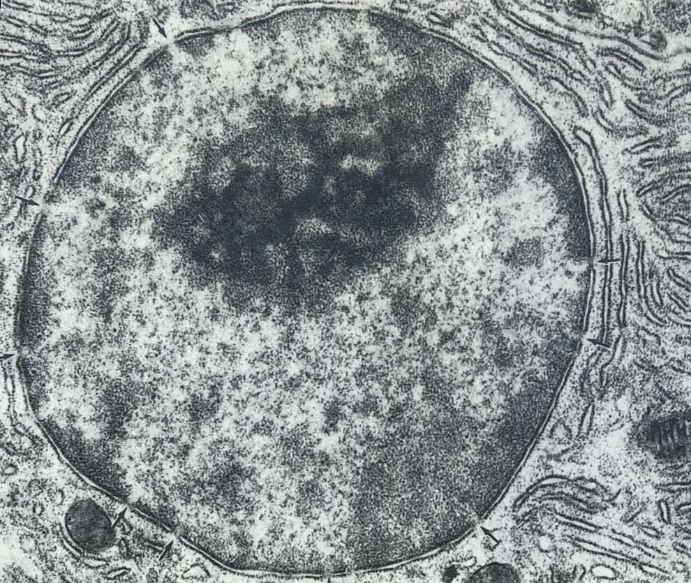 20 Micrografia eletrônica do núcleo com todos seus