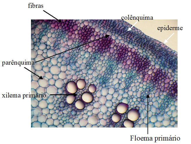 células mortas, com paredes impregnadas de lignina (pode ser comparado ao tecido