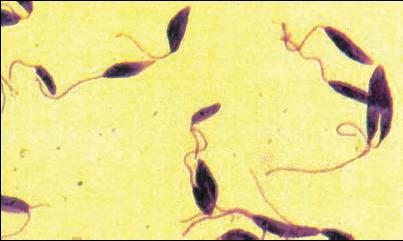 ETIOLOGIA Protozoário rio