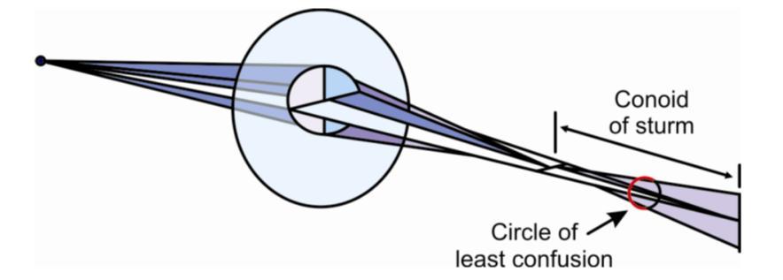 UNIDADE 4A: Exame subjetivo monocular em visão de longe Problemas no círculo de Parent 1. Astigmatismos elevados: >1.