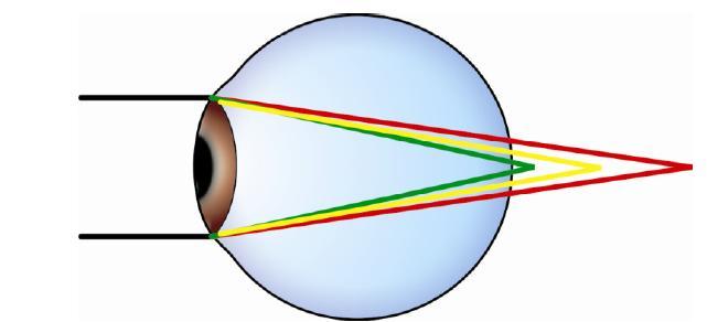 UNIDADE 4A: Exame subjetivo monocular em visão de