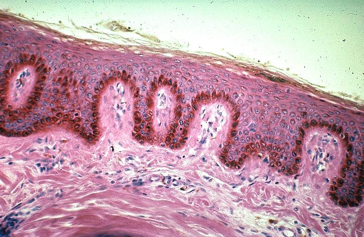 derme epiderme Pele papila dérmica crista epidérmica