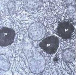 conhecido como autofagia. 8- PEROXISSOMOS- São bolsas membranosas que contêm alguns tipos de enzimas digestivas.