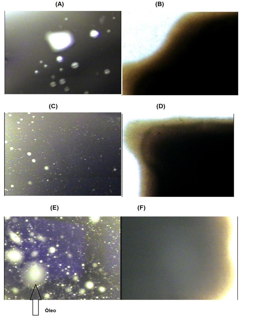120 Figura 32 - Microfotografias as amostras de óleo t4 controle, t4 consórcio A e t4 consórcio B. (A), (C) e (E) antes das desidratações e (B), (D) e (F) após as desidratações. 3.5 Cromatografia líquida Conforme mencionado no artigo 2, em todas as amostras a fração dos hidrocarbonetos saturados correspondeu a mais de 50% dos componentes do petróleo (figura 33).