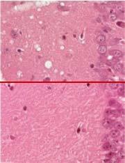 Figura 5. Dano no cérebro de cobaias (1) e recuperação, quando a conversão de prions foi parada (2)