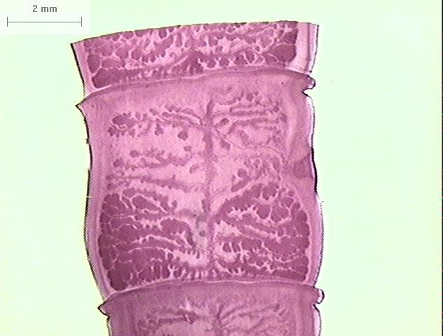 Hornink G.G., Kawazoe U., Perez D., Galembeck E. suinocultura atualmente está muito avançada e não ocorre a cisticercose nesses animais.