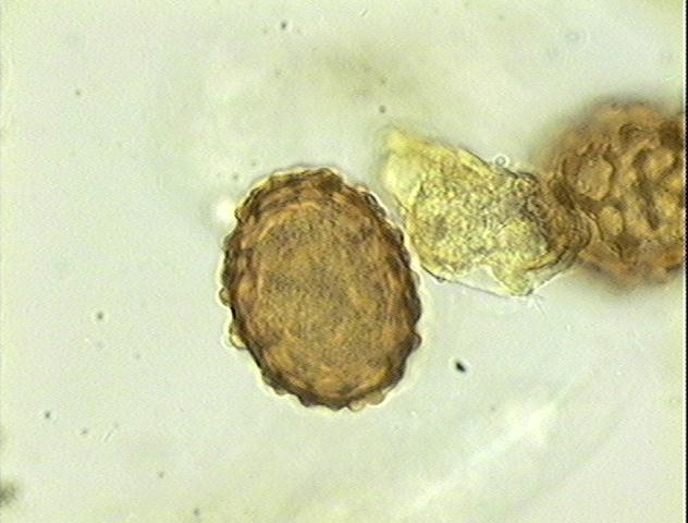 Larva rabditoide: esôfago do tipo rabditiforme (duas dilatações nas extremidades e uma