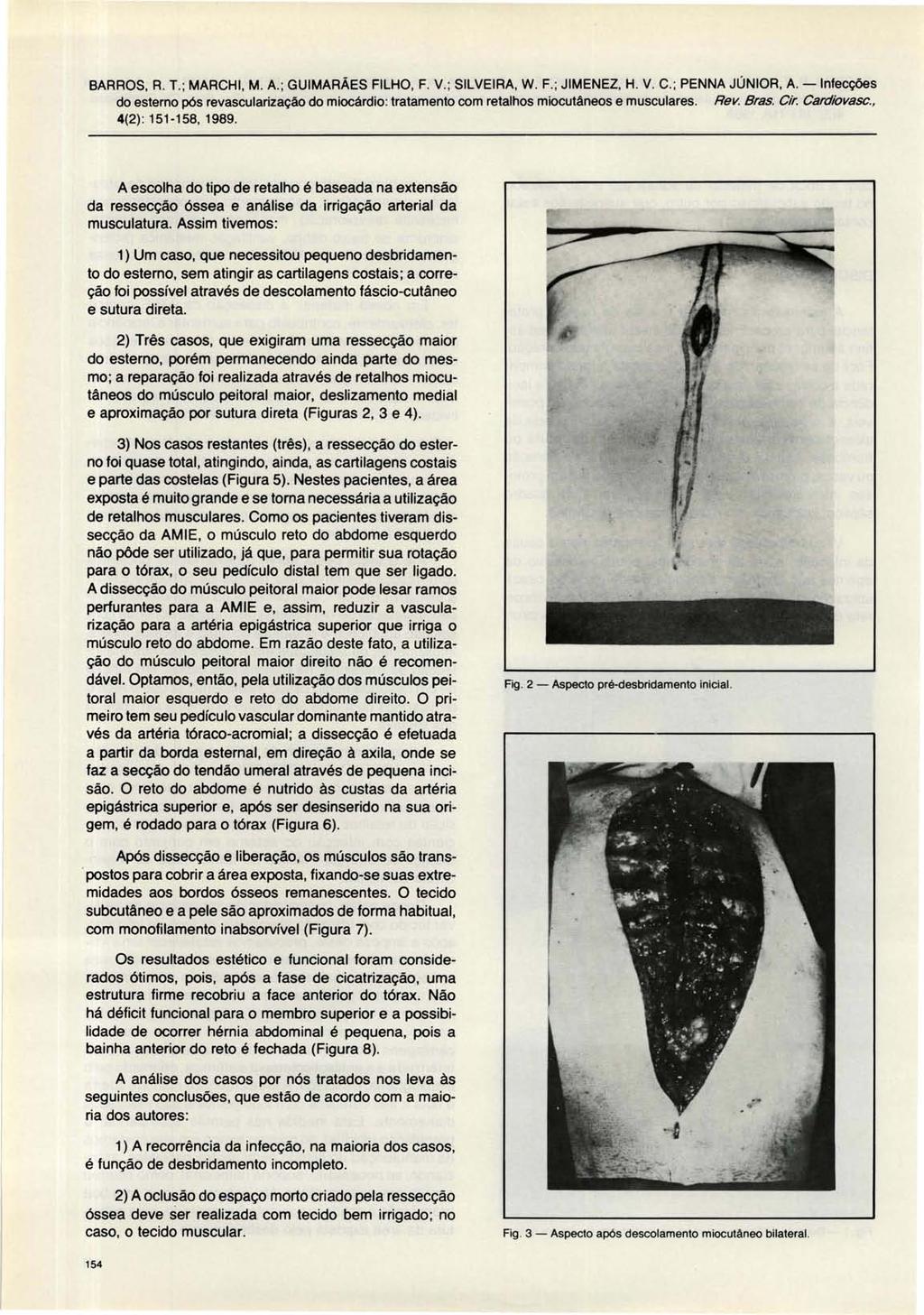 BARROS, R. T.; MARCHI, M. A.; GUIMARÃES FILHO, F. V.; SILVEIRA, W. F.; JIMENEZ, H. V. C.; PENNA JÚNIOR, A. -Infecções 4(2) : 151-158, 1989.