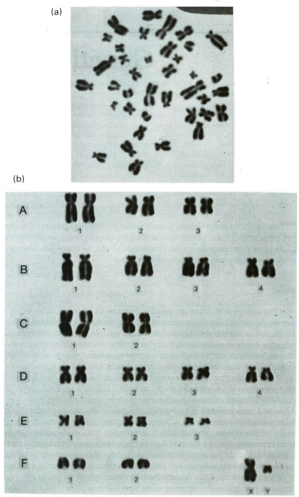 Os cromossomos de um gato macho, como são vistos ao microscópio ótico.