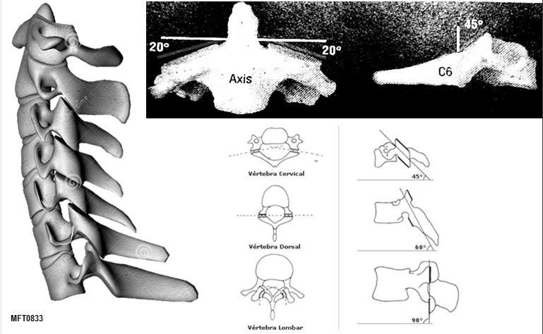 cervical inferior e se aproxima da coluna torácica.