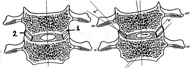 CERVICAL INFERIOR