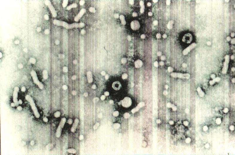 vacina 17 # VIGILÂNCIA EPIDEMIOLÓGICA - falta de informações - análise de dados: vacina, fatores de risco, surtos, estratégias de controles - todos os casos devem ser noaficados - medidas de