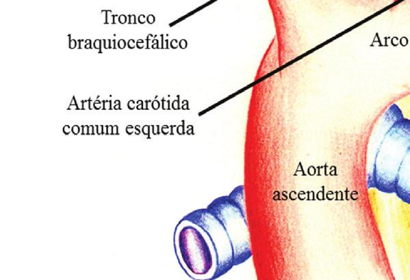 0) para estudar o grau de associação entre a falha na avaliação/classifi cação da artéria subclávia direita e o CCC fetal e índice de massa corporal (IMC) materno.