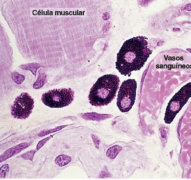 3. Mastócitos Precursores (medula óssea)