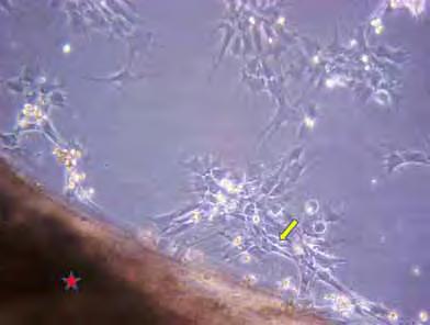 36 FIGURA 18 Selante de Fibrina (estrela vermelha) e presença das CTMs após 2 dias de cultivo com morfologia fibroblastóide (seta amarela).