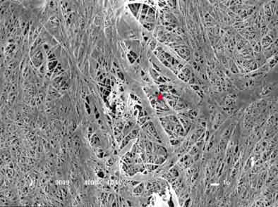 (setas amarelas). Superfície do tapete formado pela intensa rede de fibrina (estrela vermelha). MEV (2000X).