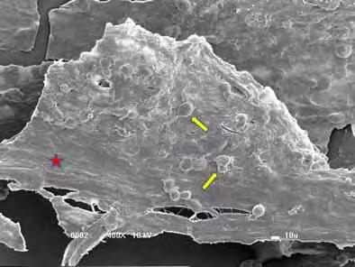 41 A microscopia eletrônica de varredura realizada no biomaterial cultivado por 8 dias na presença de células tronco mesenquimais, revelaram a capacidade do Selante de Fibrina em capturar e promover