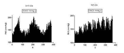 80% e 40% de 1RM) * # hypertensives (10) Normotensives (10) 40 % of 1RM To Exhaustion Leg Extension Hypertensives * *