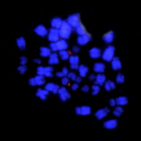 sinal de um dos homólogos, aparece mais forte. (b) Microssatélite GAG (10) com sinais no par 19 de cromossomos telocêntricos.