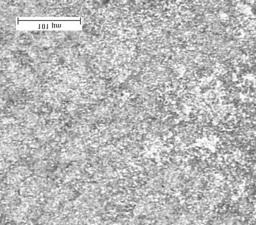Março de 2005 - CRPL Figura 12. Aço 1095, esferoidizado. Aumento de 125 X, ataque com Nital. Figura 13. Mesmo material da Figura 10, observado com aumento de 1000 X.