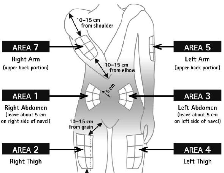 ESQUEMA DE ROTAÇÃO: 10-15 cm do ombro ÁREA 1 Braço direito (parte superior posterior) 10-15 cm do cotovelo ÁREA 2 Braço esquerdo (parte superior posterior) ÁREA 3 Abdômen direito (deixe cerca de 5 cm