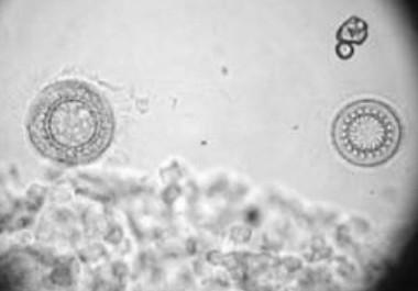 15 1.3.2 TRICODINÍDEOS São protozoários de formato arredondado e apresentam no centro do corpo um disco adesivo circundado por uma coroa de dentículos (Moraes & Martins, 2004).