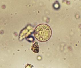 cistos de outros protozoários (NEVES, 2011). Figura 6: Trofozoítos de Entamoeba coli. Fonte: www.microbiologybook.
