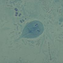 14 Figura 1: Ciclo biológico da Giardia