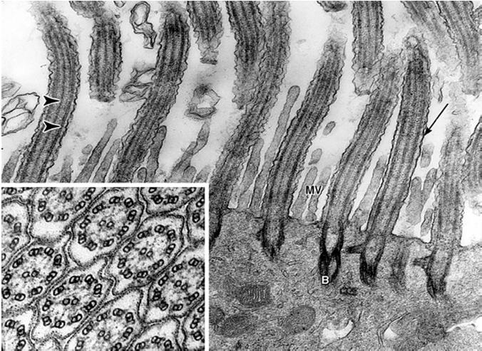 Elétron-micrografia da porção apical