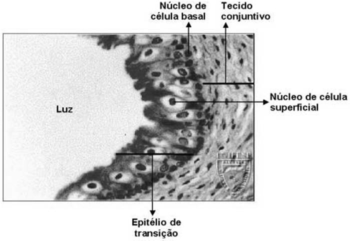 estratificado queratinizado  Bexiga