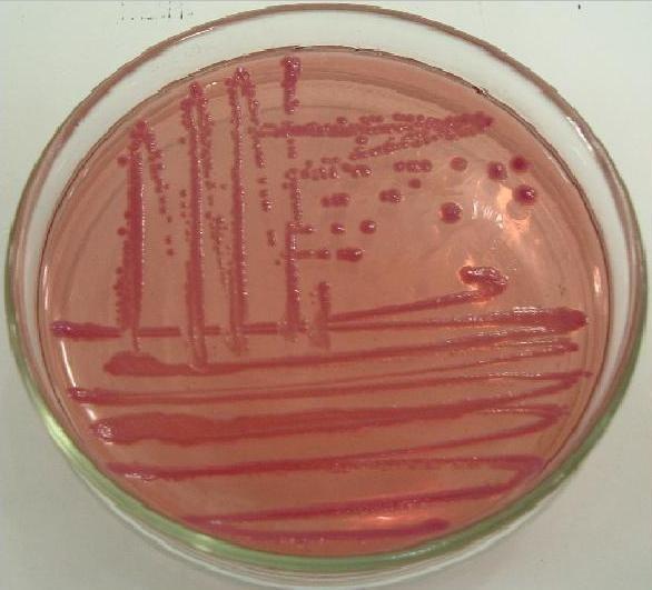 Acinetobacter Diagnóstico laboratorial: - bacterioscopia - cultura Tratamento: