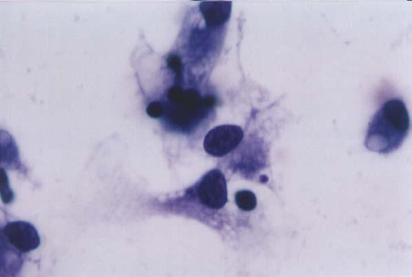 69 Figura 8 Fotomicrografia digitalizada de interação macrófago-l. braziliensis.