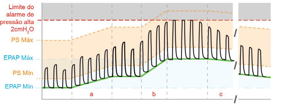 Modos de ventilação AutoEPAP ivaps mode only. Observação: Este recurso pode não estar disponível no seu dispositivo. O objetivo da EPAP é manter a patência das vias aéreas superiores.