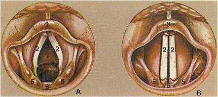 Cordas vocais 1-Glote; 2-Cordas vocais; 3-Epiglote 4-Comissura anterior 5-Cartilagens aritenóides 6-Comissura