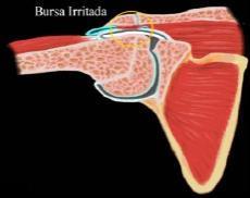 5 Braquiradial, Serrátil Anterior, Elevador da Escápula, Pronador Redondo, Grande Dorsal, Redondo Maior e Menor, Rombóide, Subescapular, Supra-Espinhal e Infra-Espinhal (SOBOTA, 2000).