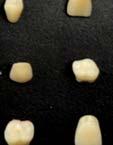 distribuição da cor dos dentes na plataforma foi a seguinte: B4, D2, C1, B2,