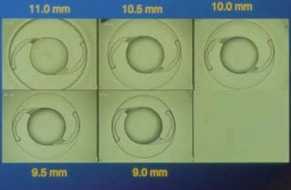 A neutralização do astigmatismo corneano durante a cirurgia da catarata por meio de lente intraocular tórica: resultados 81 Figura 5: Stableforce Fonte: Alcon Laboratórios do Brasil Figura 6: