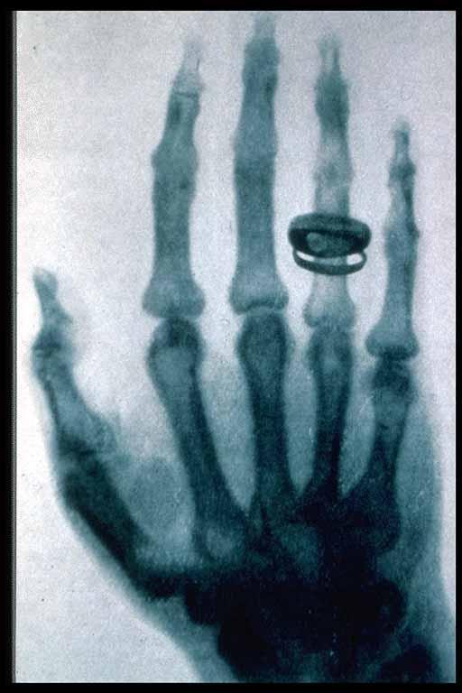 Primeira radiografia, da mão da esposa