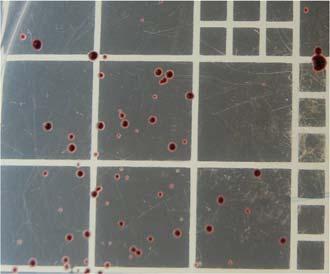 m-enterococcus Os dados obtidos foram