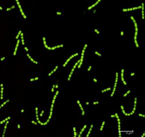 Figura 2. Imagem de microscopia de varredura confocal a laser representativa das células viáveis (Grupos II, III e IV) (fluorescência verde) das três cepas estudadas Aumento de 63x/1.3 NA; zoom.