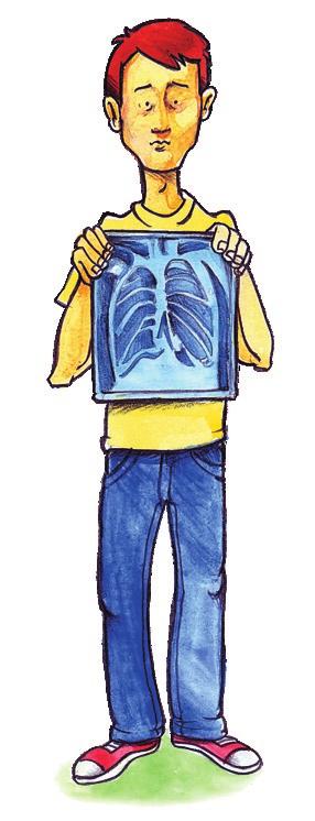13. O exame radiológico pode revelar imagens no pulmão sugestivas de tuberculose, mas não é suficiente