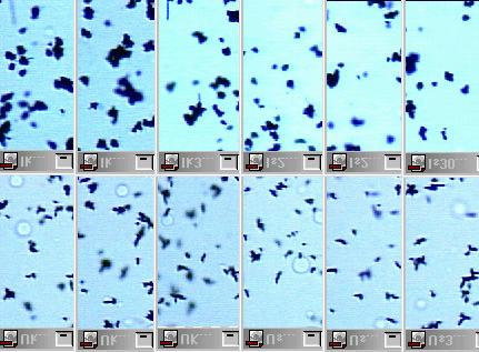 FIGURA 7 - Fotomicrografias (100X) dos cristais de prata da emulsão dos filmes radiográficos Ultra-speed e Insight, processados nas