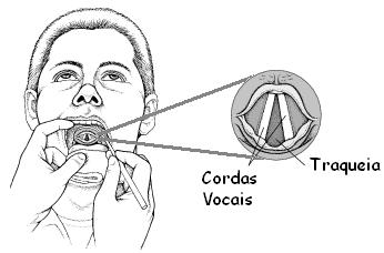 As nossas cordas vocais também são fontes sonoras. Como é que os sons chegam até nós?